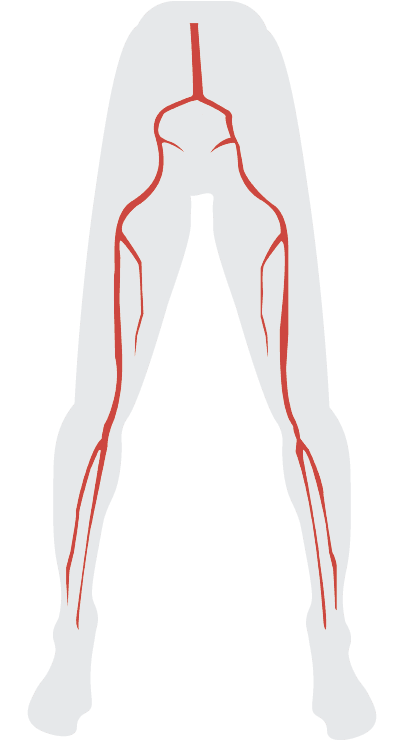 Peripheral Vasculature Diagram